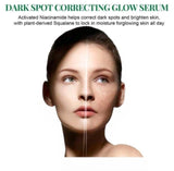 Dark Spot Correcting Glow Serum